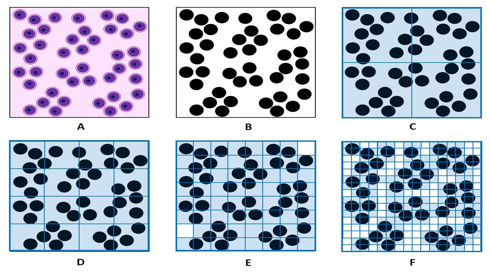 Figure 2: Fractal analysis of granule cells clusters in granular layer of cerebellar cortex, classical box counting method principle (author`s diagram) A – artificial model of granule cell clusters distribution; B – silhouette mask, binary image after segmentation; C-F – stages (iterations) of fractal analysis: C – 1st stage, box size = 1/2; D – 2nd stage, box size = 1/4; E – 3rd stage, box size = 1/8; F – 4th stage, box size = 1/16. Number of boxes containing cell silhouettes is counted (N).