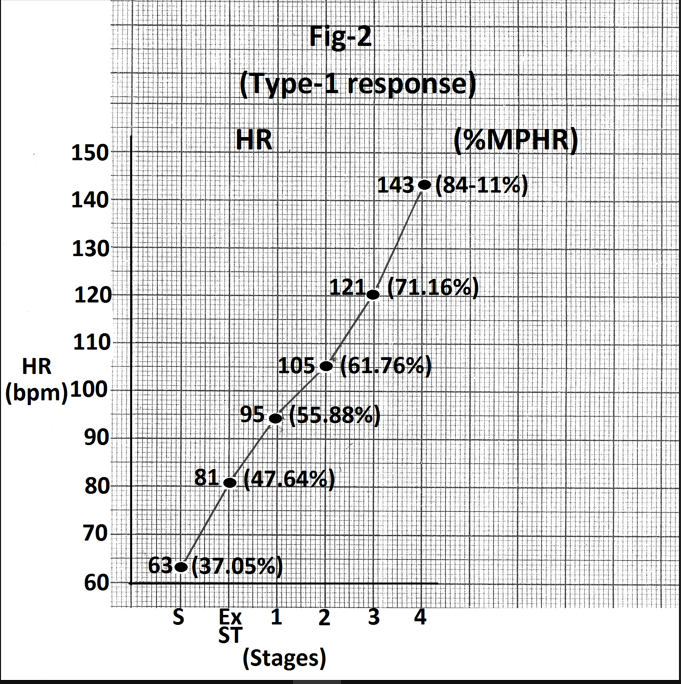 Figure 2: Graph showing heart rate response of person whose electrocardiograms are shown in figure 1. Abbreviations - HR- heart rate, bpm -beats per minute, S- Supine, Ex ST- Exercise start, ST - Stage. MPHR-percentage of age predicted maximal heart rate.