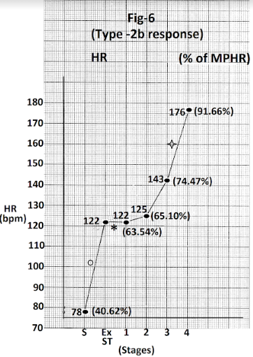 Figure 6: Graph of heart rate at the end of different stages of exercise of the person whose treadmill stress test report is shown in Figure 5. There is no increase in heart rate during stage 1(marked). There is significant increase. In heart rate (44 bpm) from supine position to start of exercise (marked O) and again in stage in (33 bpm) (marked). Abbreviations - HR- heart rate, bpm - beats per minute S- Supine, Ex ST- Exercise start, ST - Stage MPHR- percentage of age predicted maximal heart rate.