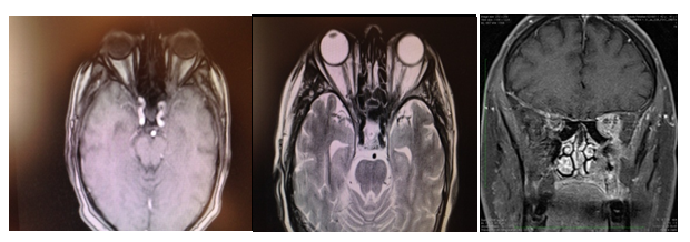 Figure 1: MRI images.
