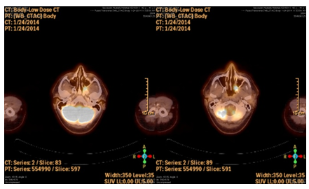 Figure 2: PET images.