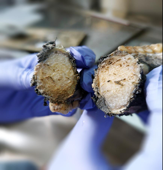 Figure 3: Gross specimen of left segmental mandibulectomy.