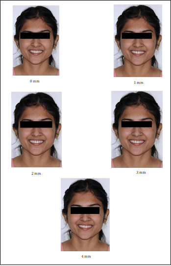 Figure 3: Visual Analog Scale.