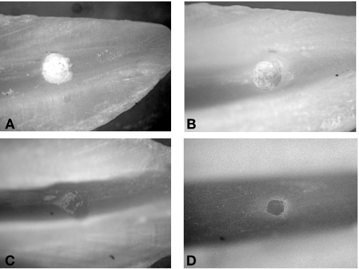 Figure 1: Representative stereomicroscope photos of dentinal debris scores. (A) orifice covered by debris in 100% of the examined area; (B) hole with debris covering more than 50% of the area; (C) hole with debris covering less than 50% of the area; (D) orifice without debris.