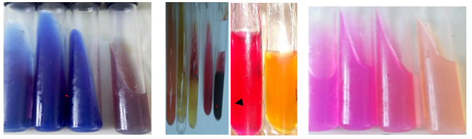 Figure 1: Detection of Salmonella and Shigella by using different biochemical tests.