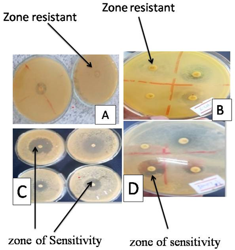 Figure 2: Different antibiotics discs on Mueller Hinton agar.