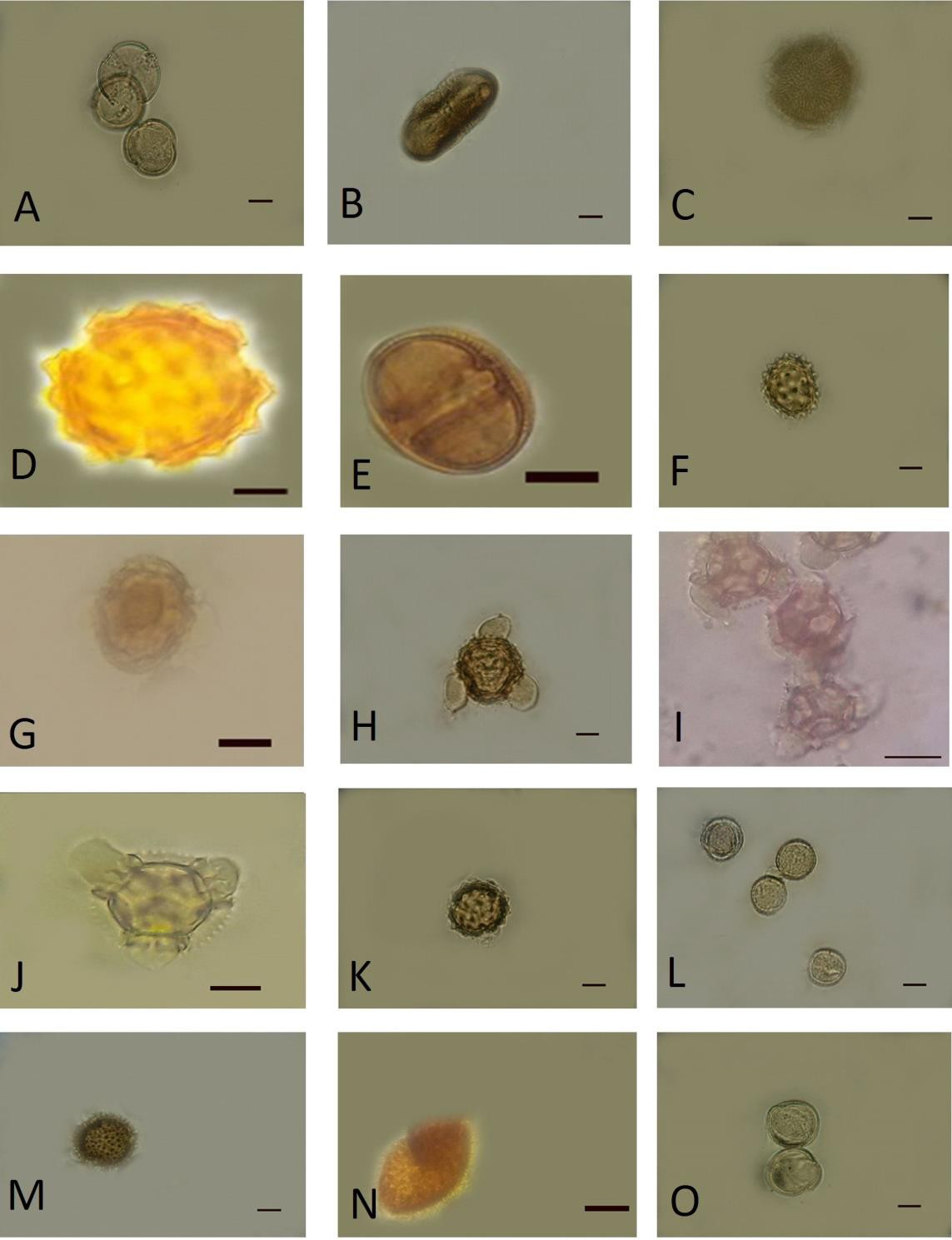 Figure 2: Achillea sp., Carduus arabicus Jacq. Ex Murray, Centaurea sp., Cirsium arvense (L.) Scop, Echinops ritrodes Bunge., Erigeron acer L., Lactuca sp., Tragopogon sp., Onopordon sp., Xanthium sp. In addition to the genera mentioned, two other pollen types were identified in the family rank and shown in Table 2 and Figure 2.
