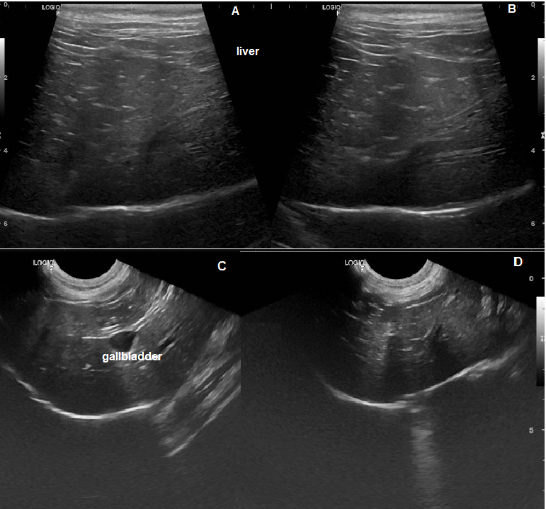 Figure 3: Ultrasound of the liver. A. and B. Liver with slightly enlarged dimensions, regular margins, slightly increased echogenicity, and preserved echotexture (hepatopathy/fatty infiltrate). C. Visualization of gallbladder. D. Liver with increased dimensions, regular margins, slightly rounded edges, maintained echogenicity and finely granular echotexture (hepatopathy).