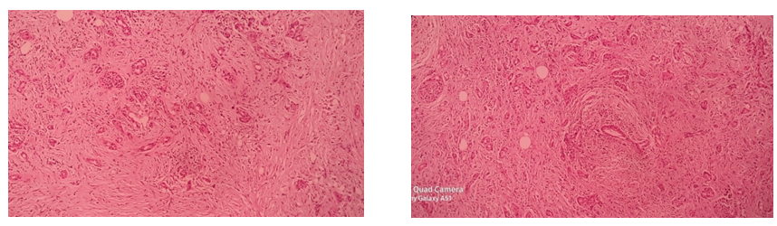 Figure 1: Biopsy Image: Pancreases.