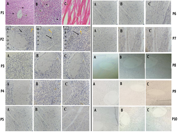 Figure 1: P 1-Photomicrographs of cattle tissue sections of A. Liver; B. Spleen; C. Heart, stained with Haematoxylin and Eosin stain. Magnification: x400. P 2-Photomicrographs of cattle spleen tissue sections stained with haematoxylin and counterstained with 20% methanolic dye extract of kola nut showing relatively indifferent cytoplasmic staining intensity of golden-brown colouration at: A. 5 min; B. 10 min; C. 15 min. Magnification x200. P 3-Photomicrograph of cattle spleen tissue sections stained with haematoxylin and counterstained with 40% methanolic dye extract of kola nut showing relatively indifferent cytoplasmic staining intensity of golden-brown colouration at: A. 5 min; B. 10 min; C. 15 min. Magnification x200. P 4-Photomicrographs of cattle spleen tissue sections stained with haematoxylin and counterstained with 60% methanolic dye extract of kola nut showing relatively intesne cytoplasmic staining reaction of golden-brown colouration at: A. 5 min; B. 10 min; C. 15 min. Magnification x200. P 5-Photomicrographs of cattle heart tissue sections stained with haematoxylin and counterstained with 20% methanolic dye extract of kola nut for A. 5 min; B. 10 min; C. 15 min; (cytoplasmic staining observed as golden-brown colouration without clear distinction at varying staining times). Magnification x200. P 6Photomicrographs of cattle heart tissue sections stained with Haematoxylin and counterstained with 40% methanolic dye extract of kola nut for A. 5 min; B. 10 mi; C. 15 min; (cytoplasmic staining observed as golden- brown colouration showing relatively uniform intensity at varying staining times). Magnification x200. P 7-Photomicrographs of cattle heart tissue sections stained with Haematoxylin and counterstained with 60% methanolic dye extract of kola nut for A. 5 min; B. 10 min; C. 15 min; (cytoplasmic staining observed as golden- brown colour with increasing intensity relative to staining time). Magnification x200. P 8-Photomicrographs of cattle liver tissue sections, stained with Haematoxylin and counterstained with 20% methanolic dye extract of kola nut for A. 5 min; B. 10 min; C. 15 min (cytoplasmic staining observed as golden-brown colouration with staining intensity not relative to staining time). Magnification x100. P 9-Photomicrographs of cattle liver tissue sections stained with Haematoxylin and counterstained with 40% methanolic dye extract of kola nut for A. 5 min; B. 10 min; C. 15 min (cytoplasmic staining observed as golden-brown colouration with relatively uniform staining intensity). Magnification x100. P10-Photomicrographs of cattle liver tissue sections stained with Haematoxylin and counterstained with 40% methanolic dye extract of kola nut for A. 5 min; B. 10 min; C. 15 min (cytoplasmic staining observed as golden-brown colouration with raltively uniform staining intensity). Magnification x100.