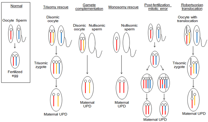 Figure 4: Schematic of the uniparental disomy inheritance pattern that mosaic trisomy syndrome of chromosome 14 follows this pattern [1].