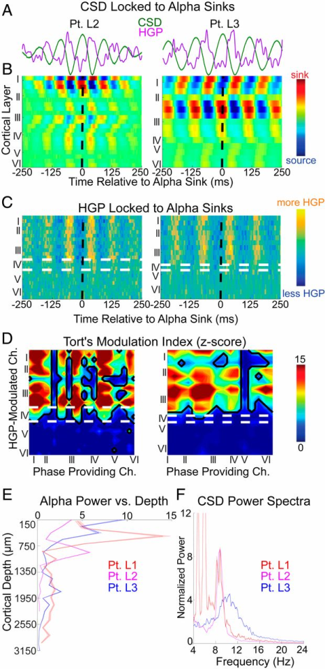 Figure 6: Figure illustrates Alpha CSD and HGP are maximal in supragranular cortex. (A) Average CSD and HGP waveforms of a single channel on the same time axes as B (±SEM across alpha sinks). (B and C) CSD (B) and HGP (C) averaged on current sinks in channels 3 and 6 in Pts. L2 and L3, respectively; white and black dashed lines indicate layer IV boundaries and the time of the alpha sink, respectively. (D) Z score of the MI between alpha phase and HGP across all channels (Ch.). (E) Average alpha power throughout the cortical depth (±SEM across epochs). (F) Power spectra of the channel with greatest alpha power in each subject (±SEM across epochs) [11].