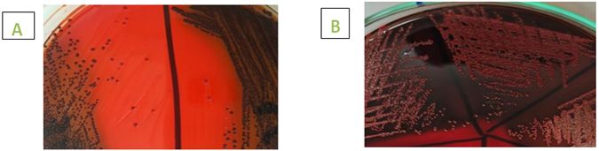 Figure 5: CPSA and CNSA on CRD medium, slime producer (A) showing black colonies and non-slime producer (B) showing red colonies.