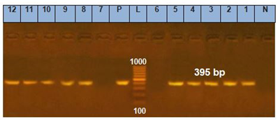 Figure 6: Some studies [26,331,32] detected _nuc_ gene in all (100%) tested atypical _S. aureus strains, while nuc_ gene was found among 97.3, 85% and 66.7 % of the _S. aureus_ isolates; [28,40,41], respectively. Out of 35 _staphylococcus_ strains, 16 isolates were possessed _nuc_ gene specific of _S. aureus_, [18].