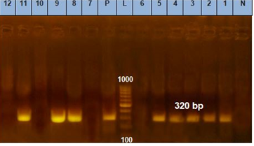 Figure 8: During previous studies [18,41,49], _spa_ gene in X-region binding was detected in all typical and atypical _S. aureus_ isolates, while it was detected in 26 (70.3%) _S. aureus_ isolates [40]. Atypical _S. aureus_ strains seem not to be differed in genetic ability to poses very virulence adhesins genes from typical _S. aureus_ strains [46,50].