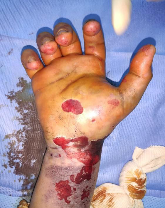 Figure 3: Postoperative Scopic Checks.