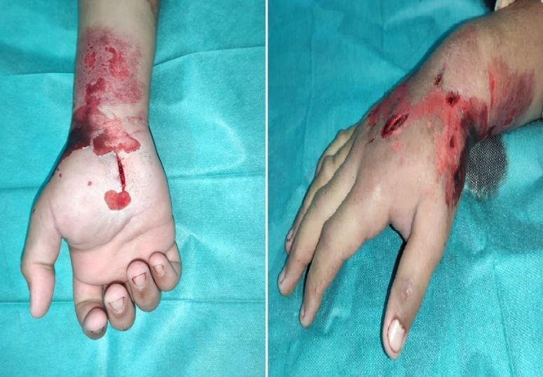Figure 6: Clinical and radiological control in the sixth month.